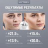 Аппарат для лифтинга и фотоомоложения с DPL, NIR и EMS MYTREX MiRAY ONE